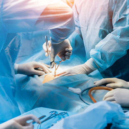 General & Laparoscopic Surgery